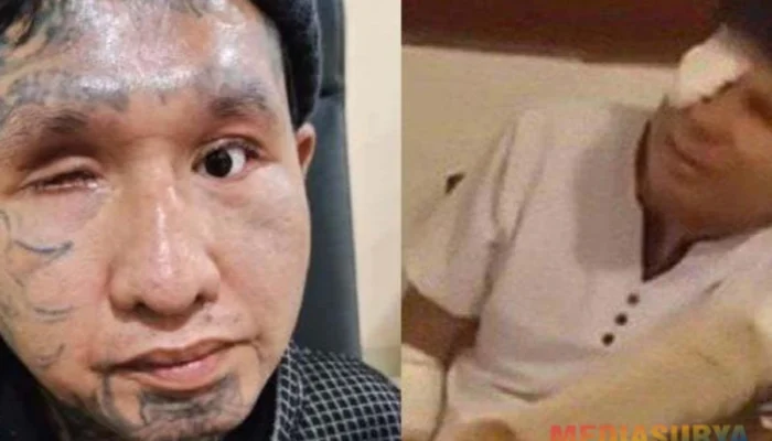 Beda Nasib Korban Kekerasan, Icang Jalani Operasi Mata, Agus Salim Masih Menanti Bantuan